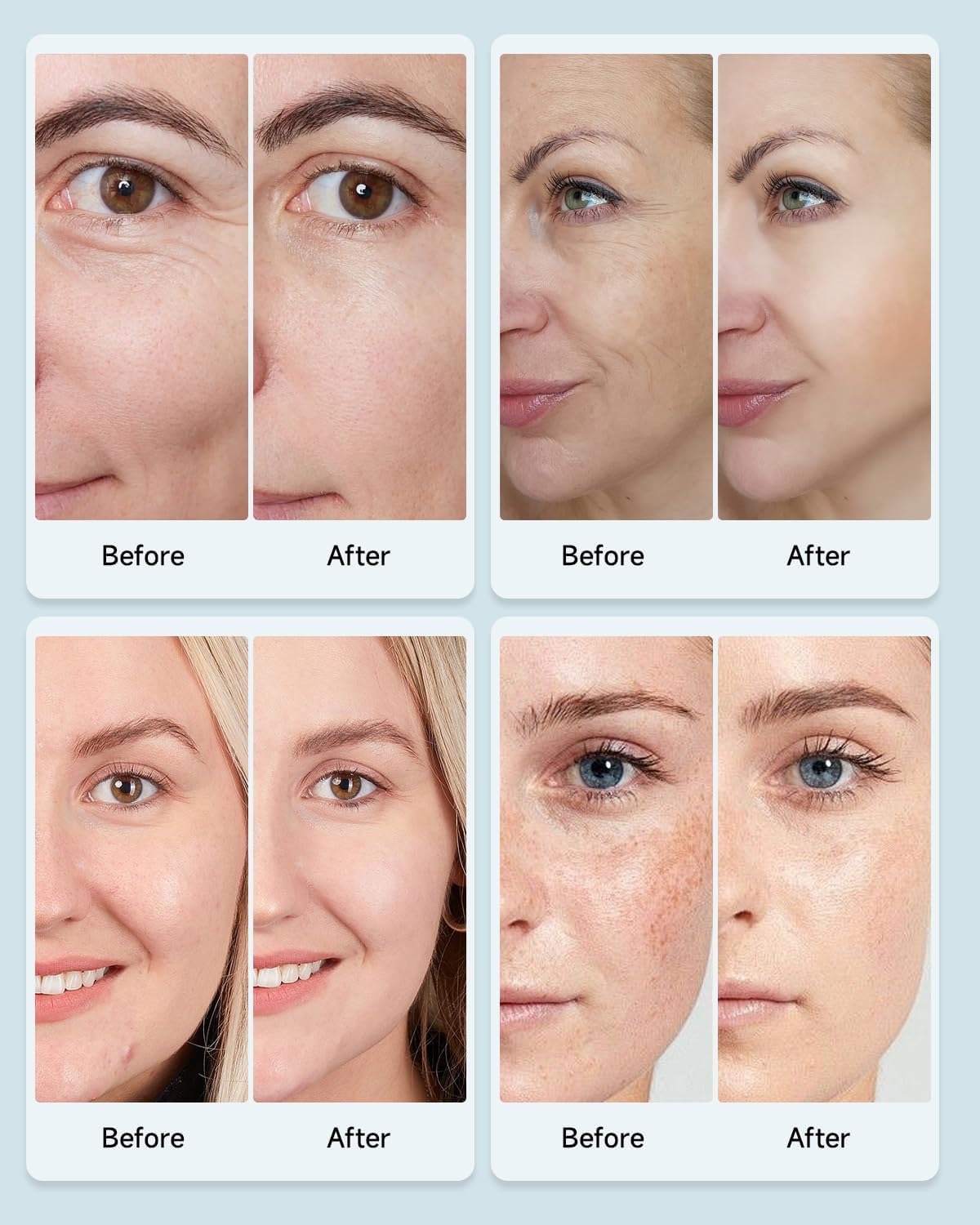 LED Therapy Face Mask